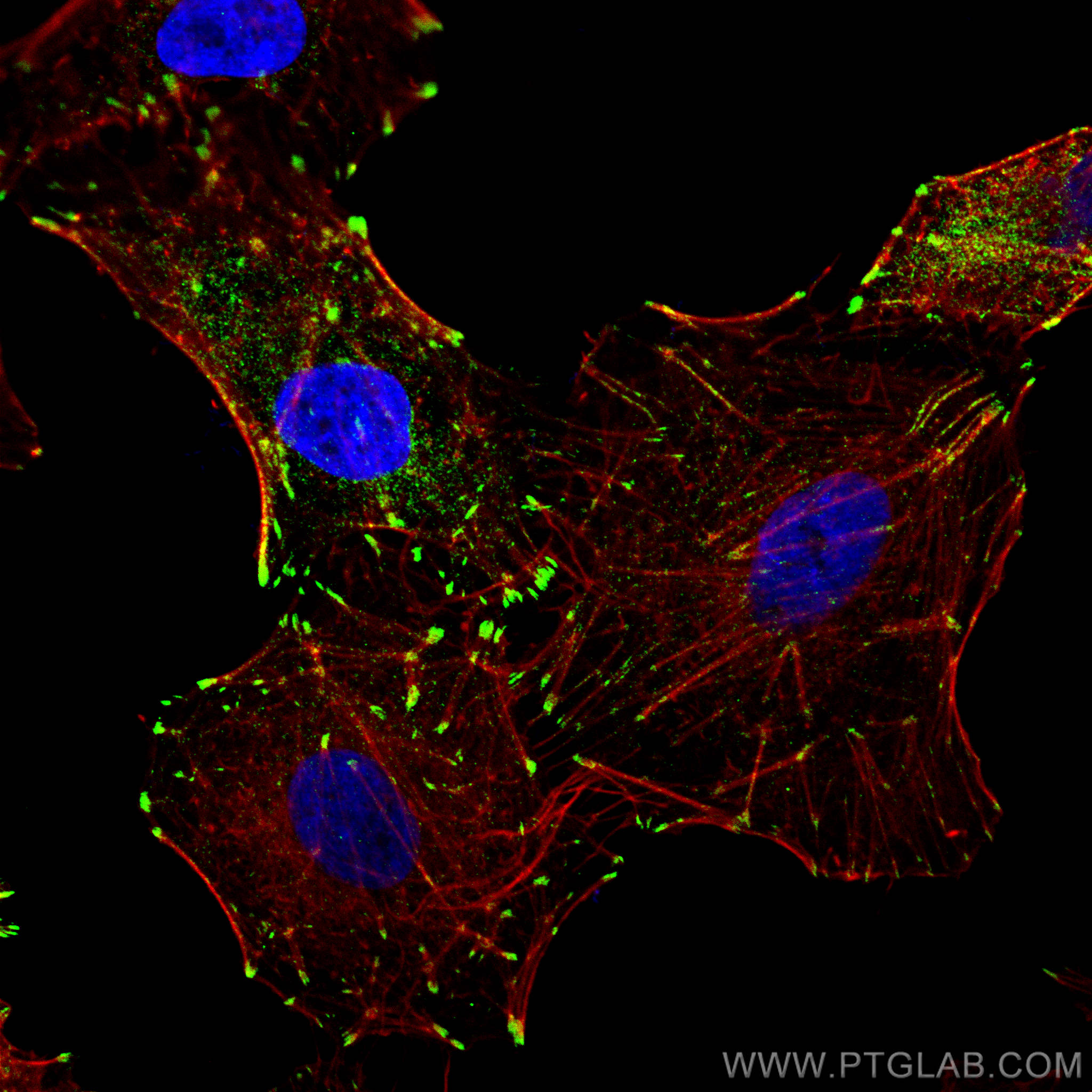 IF Staining of A549 using 10330-1-AP