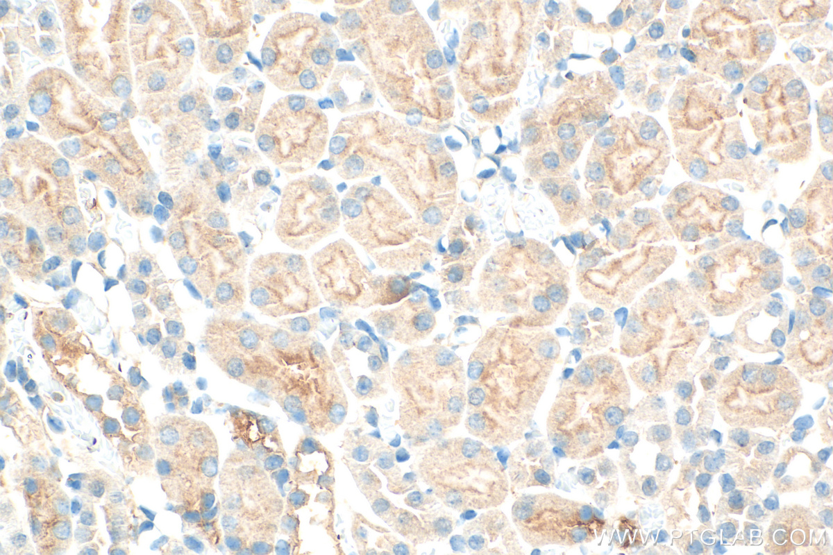 IHC staining of mouse kidney using 10330-1-AP