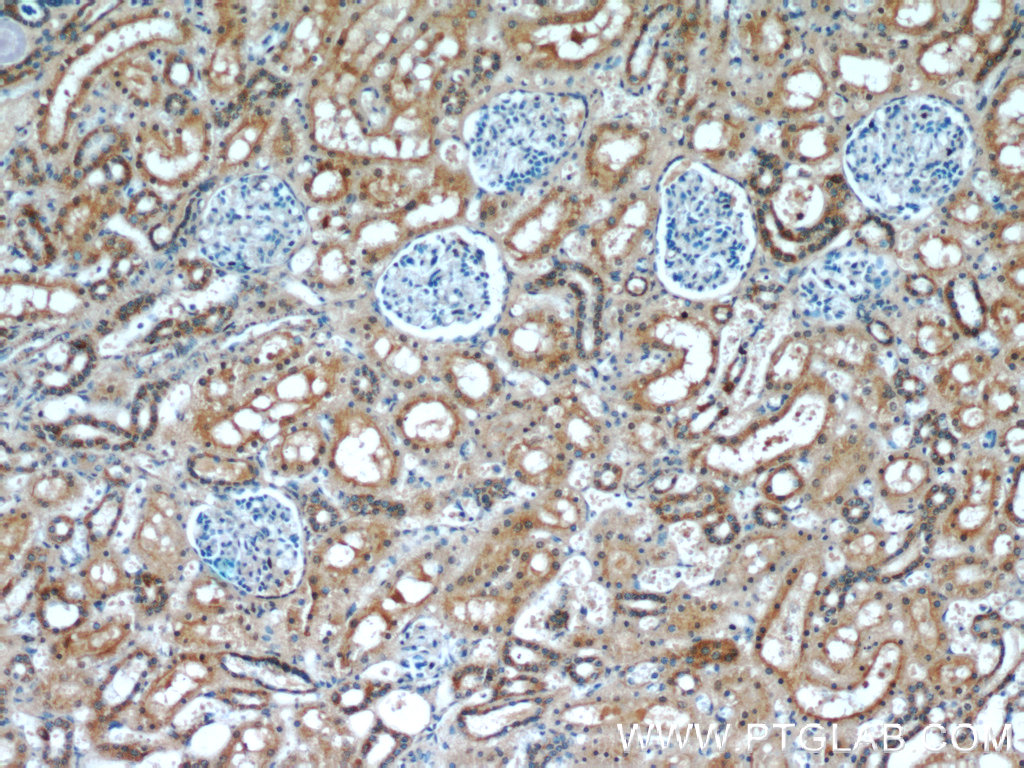 IHC staining of human kidney using 60254-1-Ig