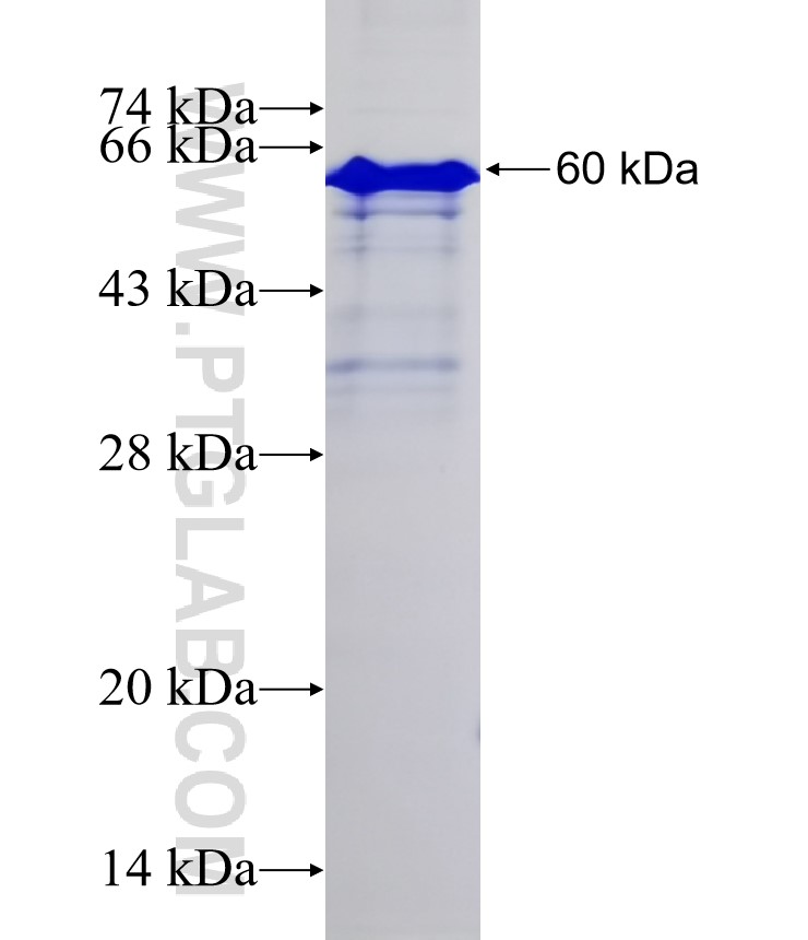 ZYX fusion protein Ag0419 SDS-PAGE