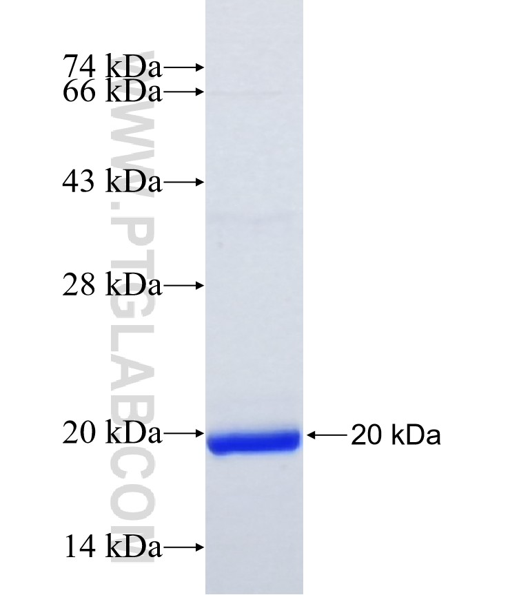 ZZEF1 fusion protein Ag35499 SDS-PAGE ZZEF1 fusion protein Ag35499 SDS-PAGE