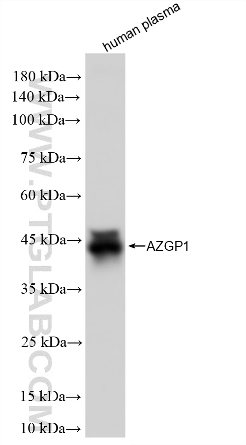 WB analysis of human plasma using 86781-3-RR (same clone as 86781-3-PBS) WB analysis of human plasma using 86781-3-RR (same clone as 86781-3-PBS)