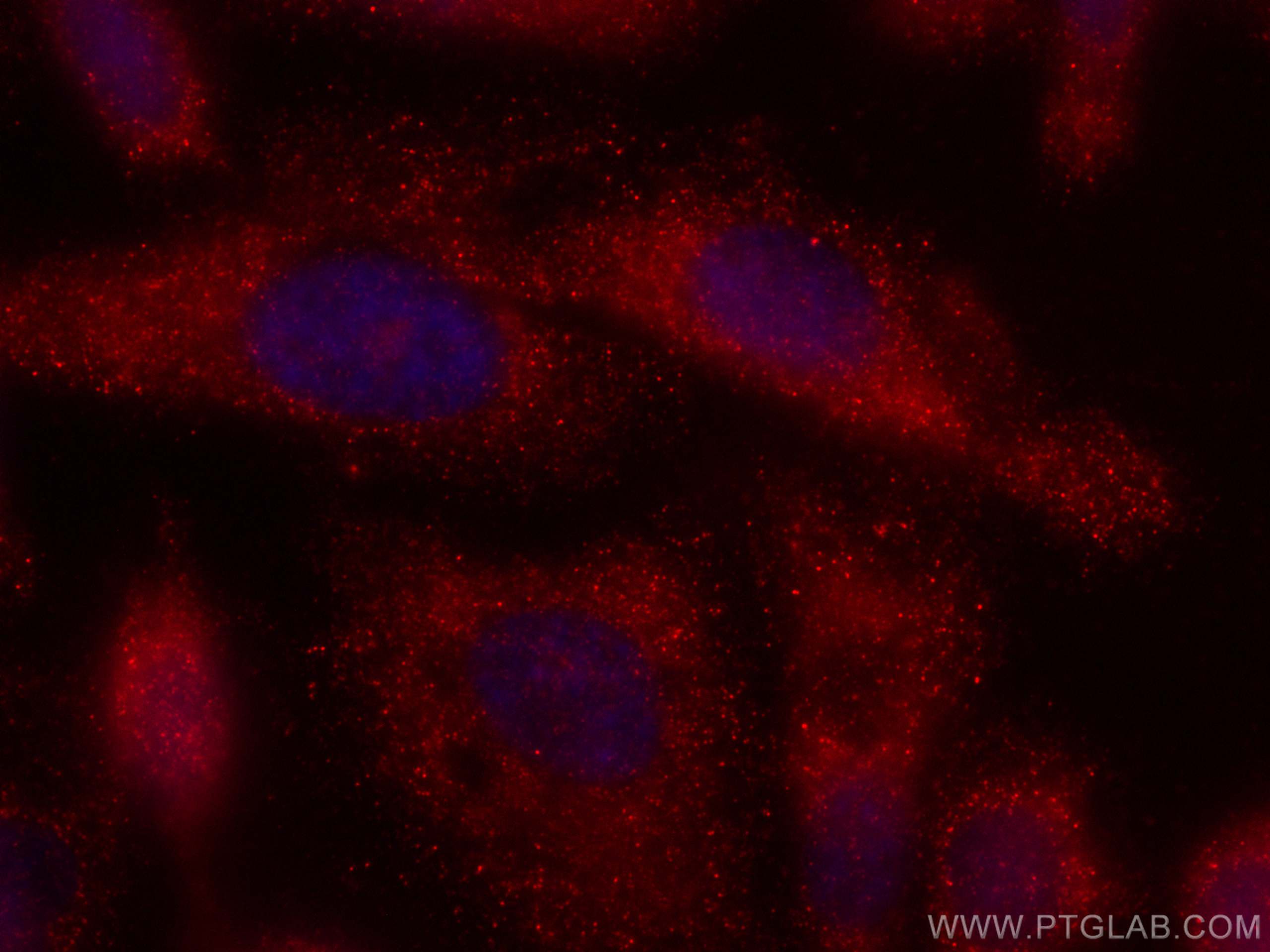 Zinc Alpha 2 Glycoprotein