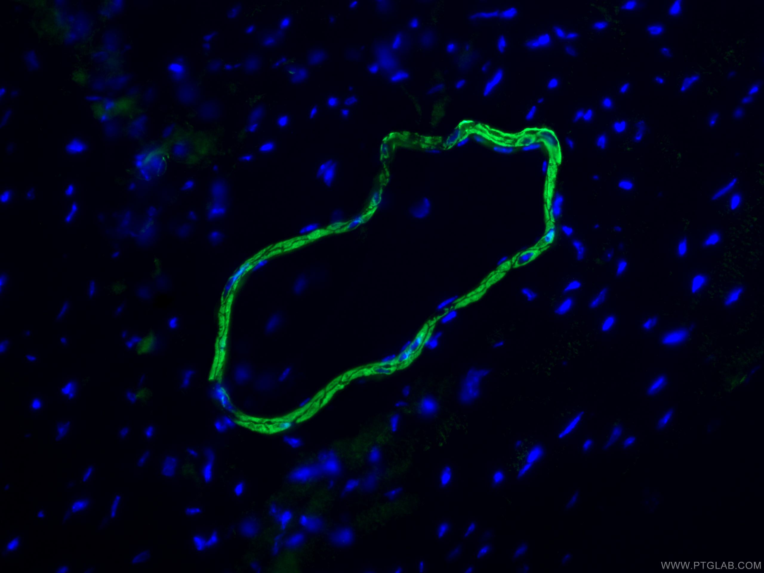 IF Staining of mouse heart using 80008-1-RR