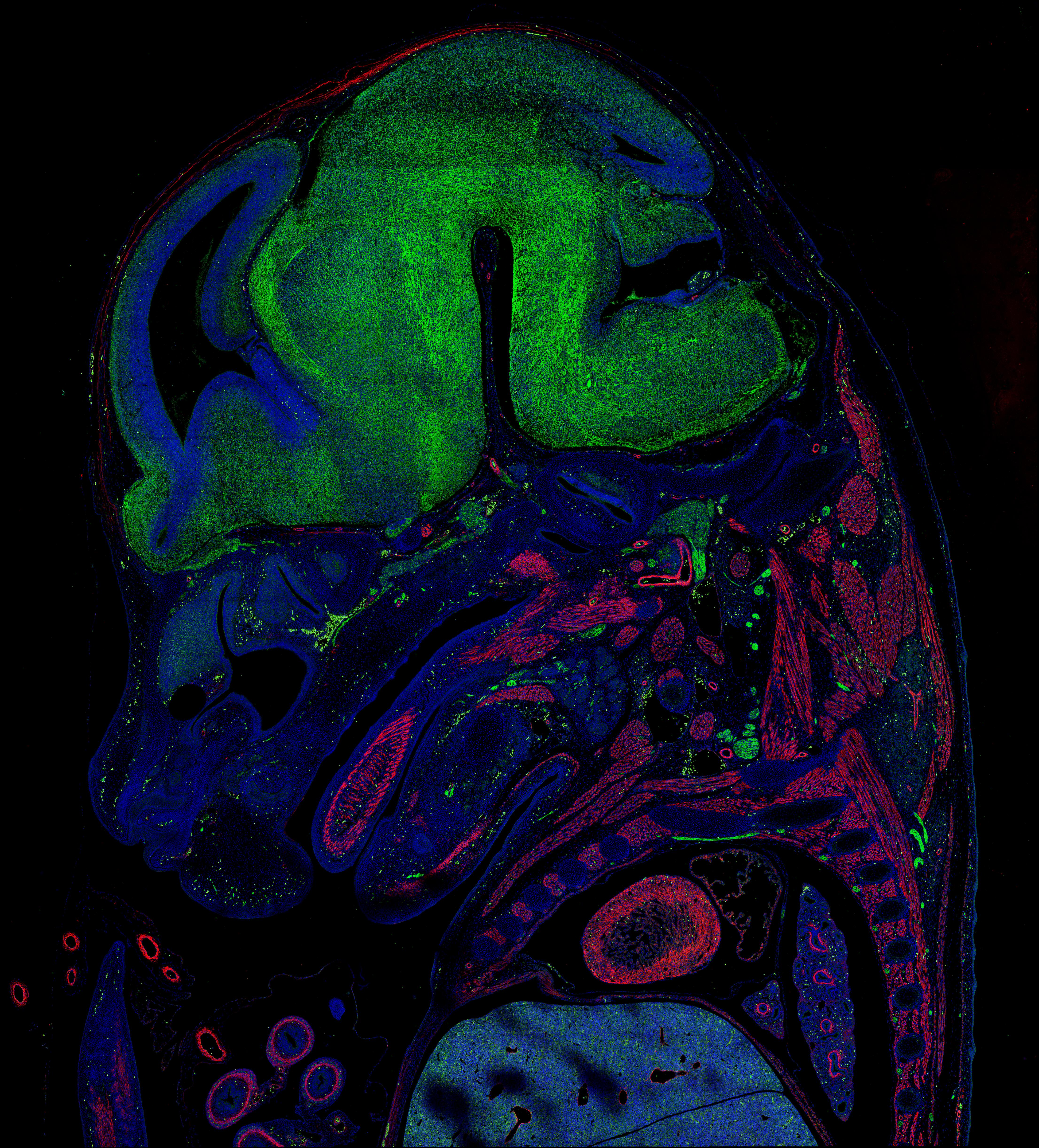 IF Staining of mouse embryo using 80008-1-RR (same clone as 80008-1-PBS)