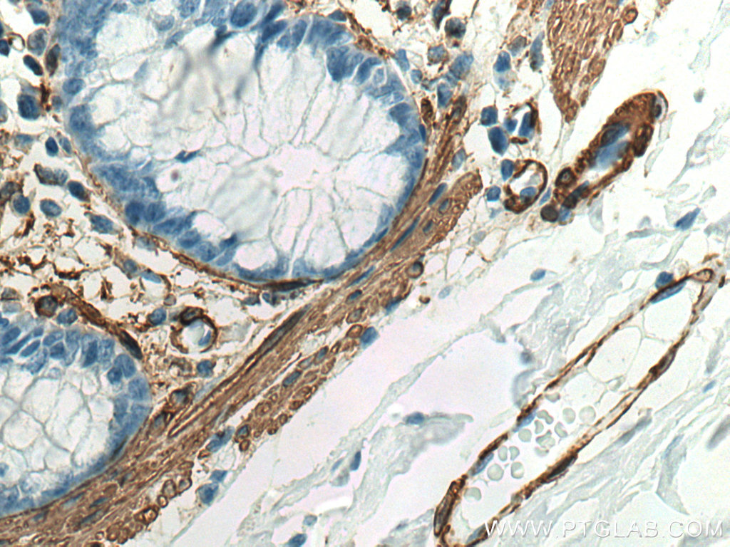 IHC staining of human colon using 80008-1-RR