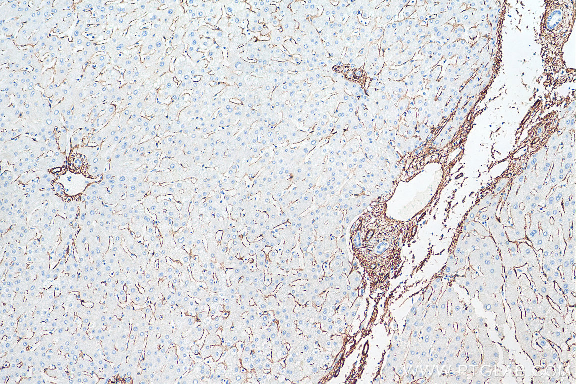 IHC staining of human liver using 80008-1-RR (same clone as 80008-1-PBS)