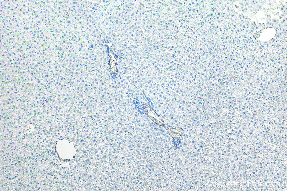 IHC staining of rat liver using 80008-1-RR IHC staining of rat liver using 80008-1-RR