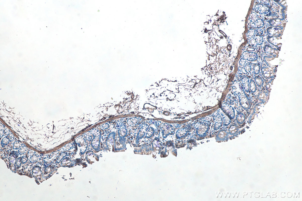 IHC staining of rat colon using 80008-1-RR IHC staining of rat colon using 80008-1-RR