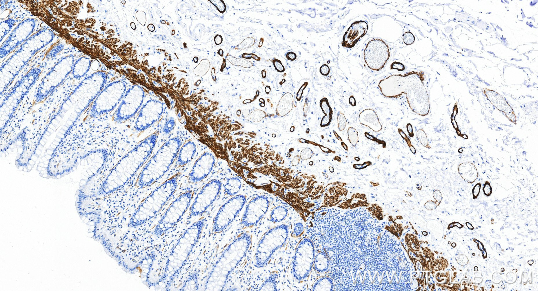IHC staining of human colon using 80008-2-RR (same clone as 80008-2-PBS) IHC staining of human colon using 80008-2-RR (same clone as 80008-2-PBS)