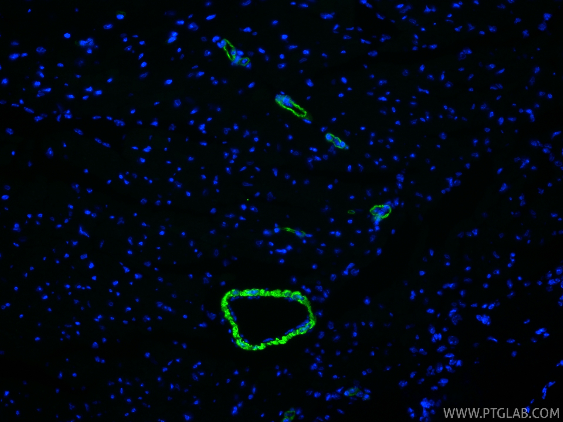 IF Staining of mouse heart using 80008-2-RR (same clone as 80008-2-PBS) IF Staining of mouse heart using 80008-2-RR (same clone as 80008-2-PBS)