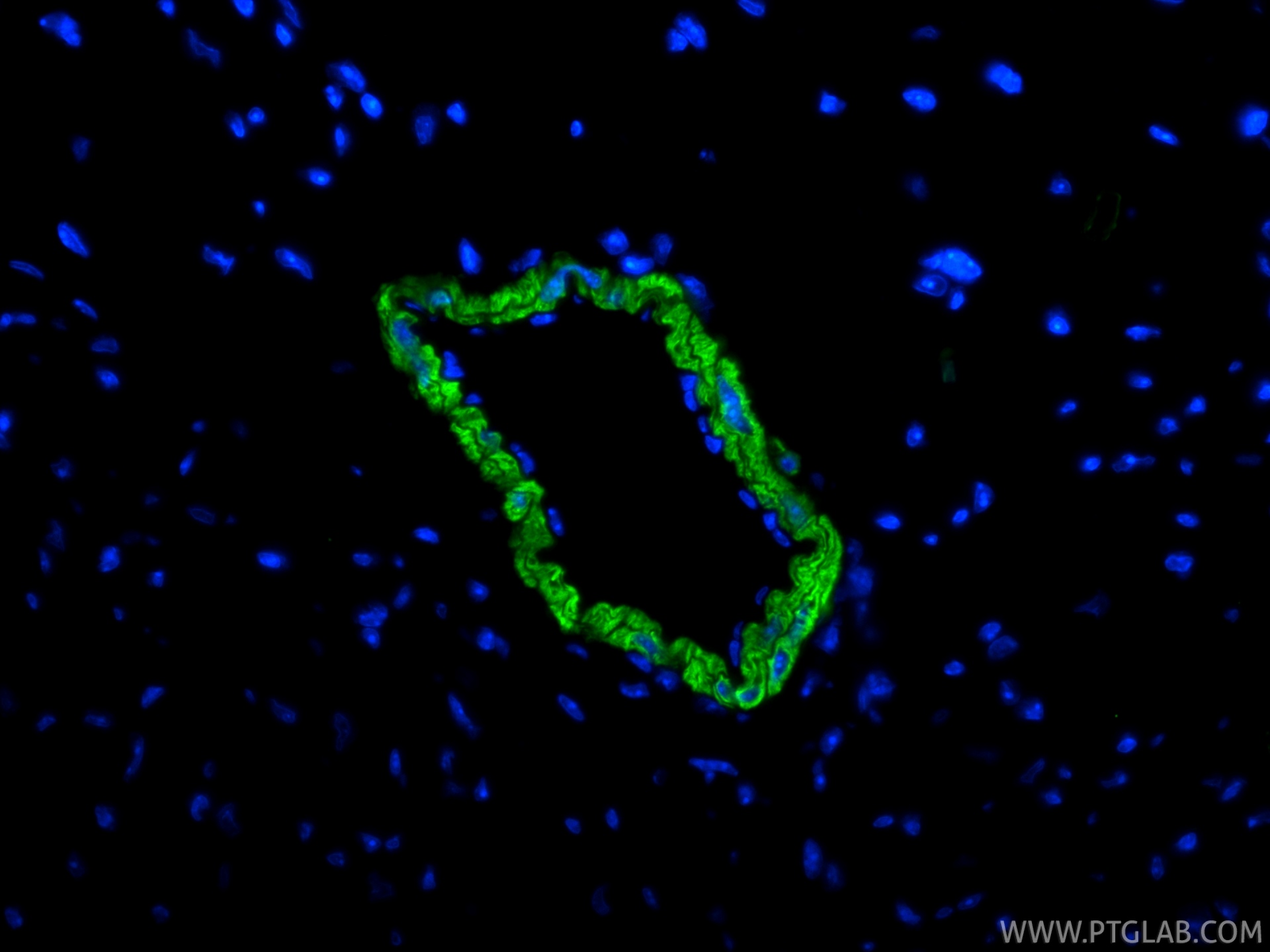IF Staining of mouse heart using 80008-2-RR (same clone as 80008-2-PBS) IF Staining of mouse heart using 80008-2-RR (same clone as 80008-2-PBS)