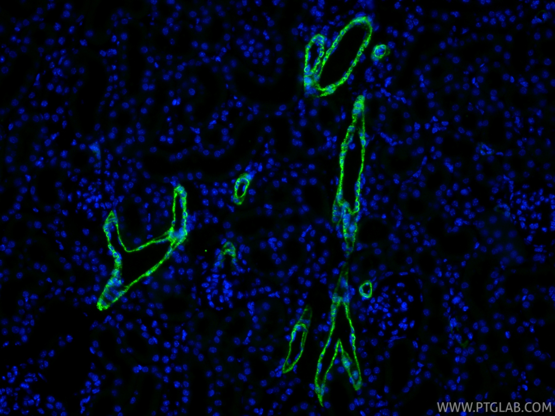 IF Staining of mouse kidney using 80008-2-RR (same clone as 80008-2-PBS) IF Staining of mouse kidney using 80008-2-RR (same clone as 80008-2-PBS)