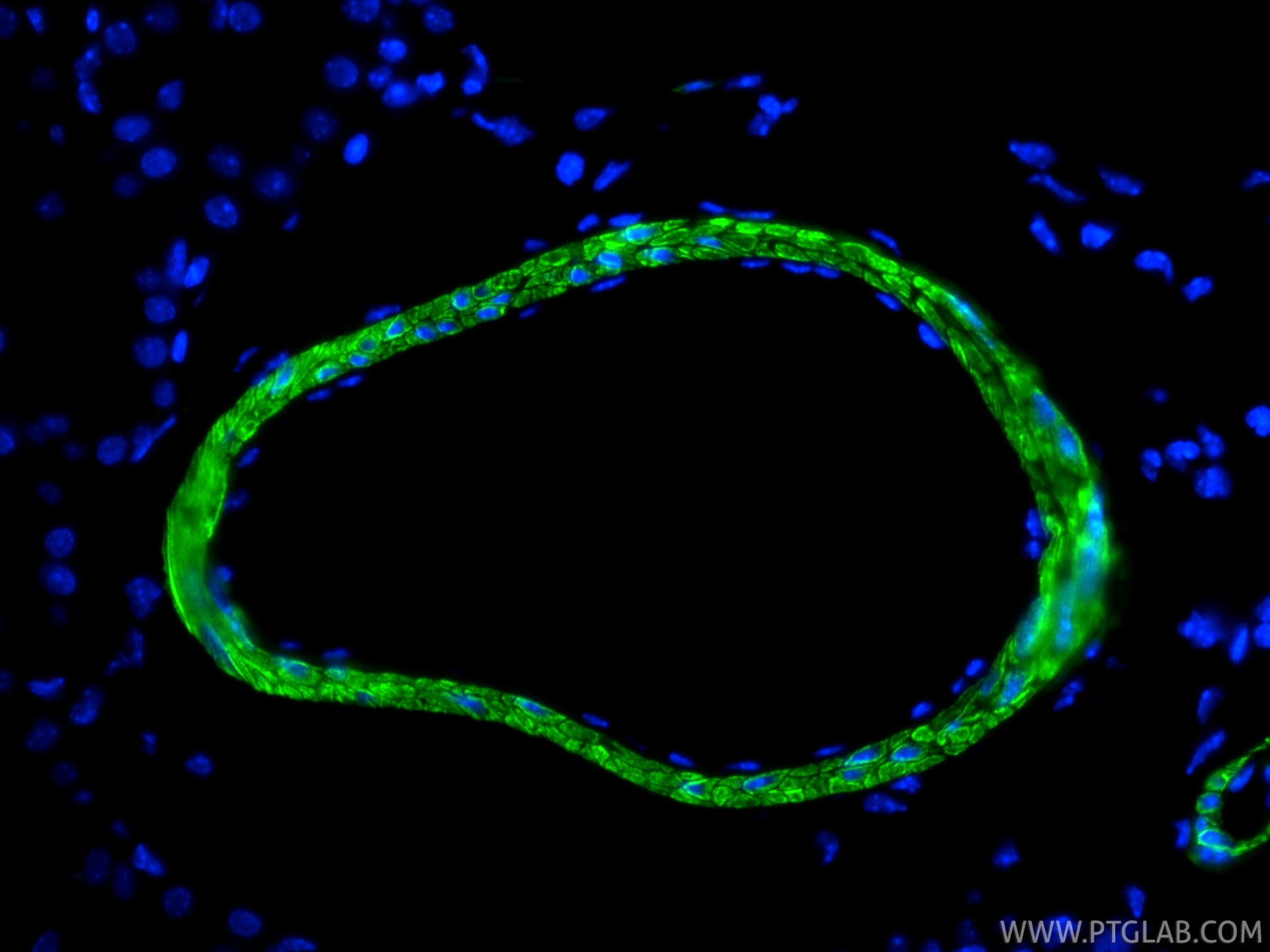 IF Staining of mouse kidney using 80008-2-RR (same clone as 80008-2-PBS) IF Staining of mouse kidney using 80008-2-RR (same clone as 80008-2-PBS)