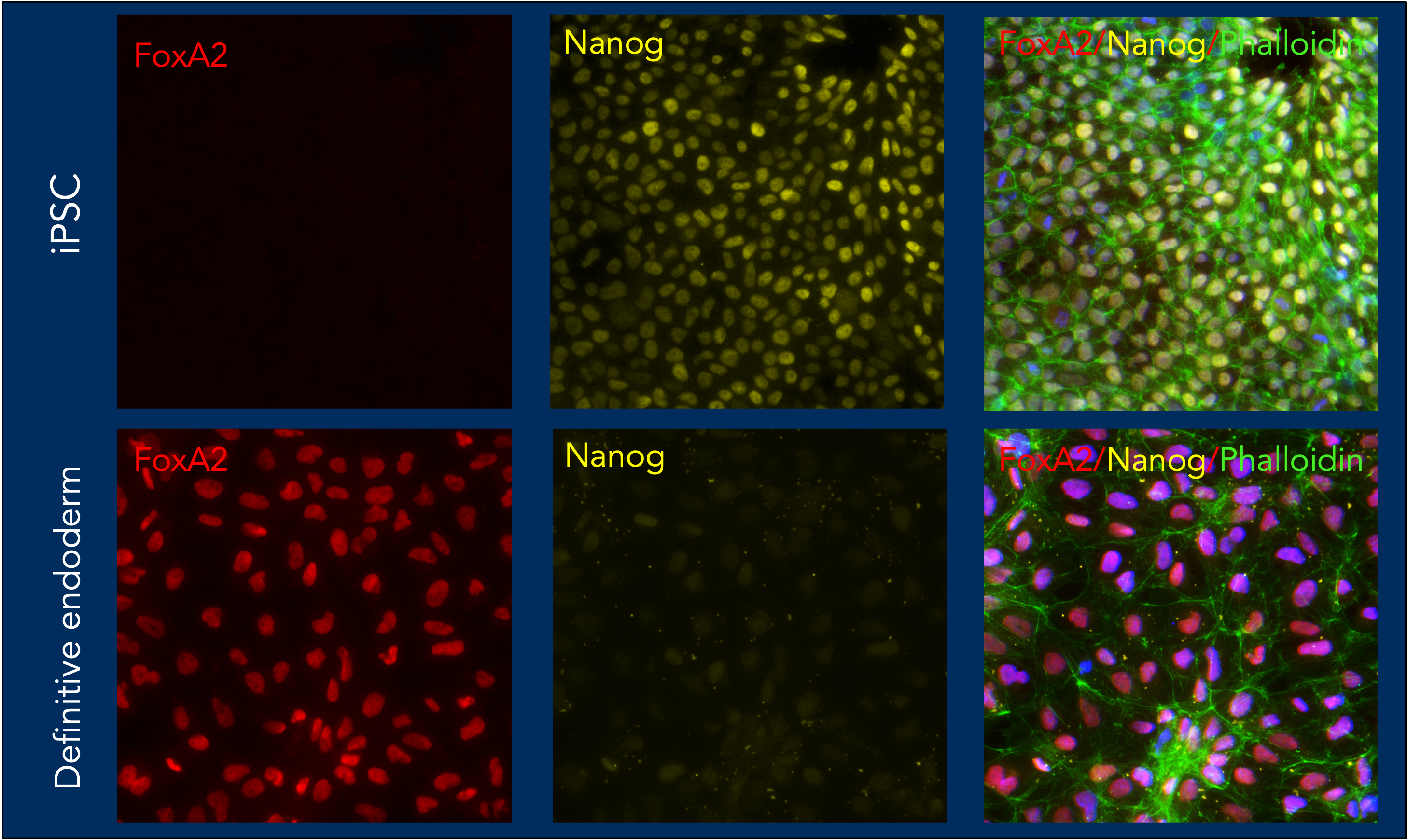 Human induced pluripotent cells(iPSCs) were differentiated to definitive endoderm using HumanKine growth factors (Activin A- HZ-1138, bFGF-HZ-1285, BMP-4- HZ-1045, and Wnt3A-HZ-1296). The differentiation was confirmed by detection of expression of FOXA2(Red) and downregulation of pluripotency marker NANOG(yellow), in immunofluorescence