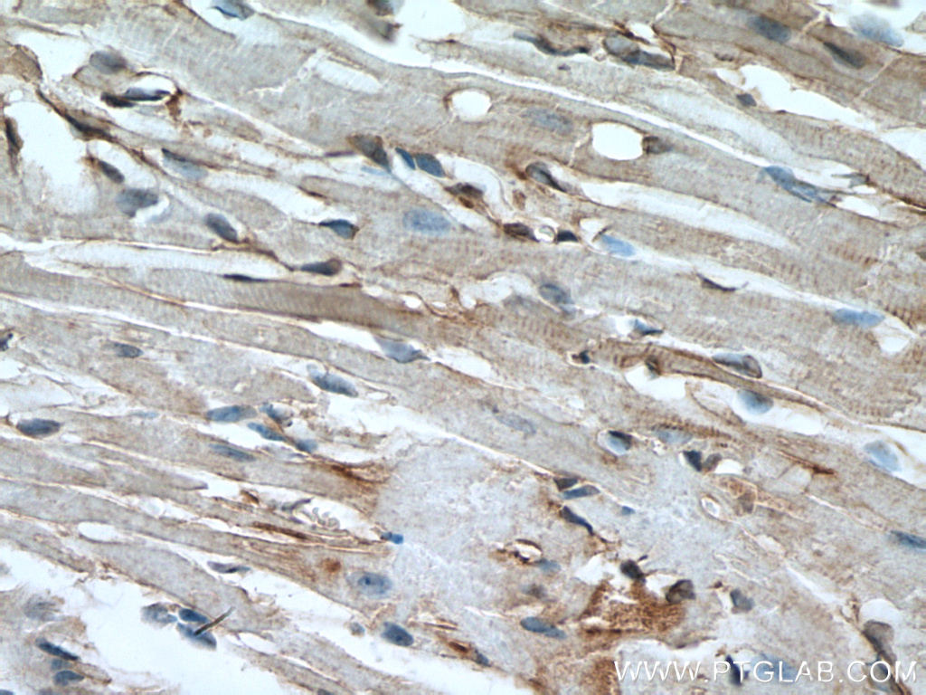 IHC staining of mouse heart using 66895-1-Ig (same clone as 66895-1-PBS)