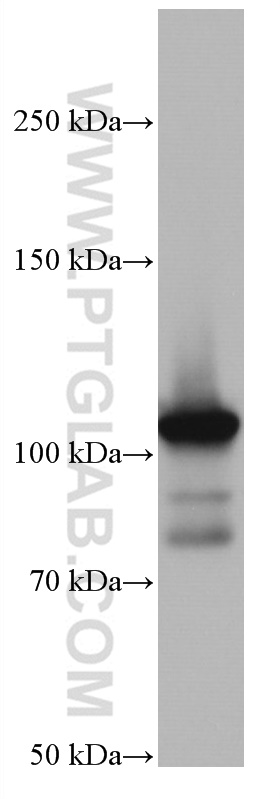 Alpha Actinin