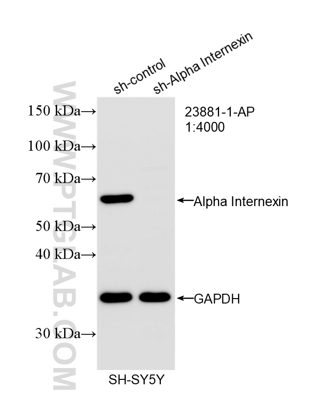 WB analysis of SH-SY5Y using 23881-1-AP WB analysis of SH-SY5Y using 23881-1-AP