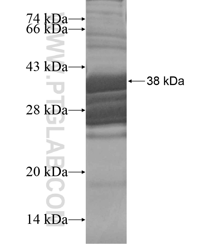 atg8 fusion protein Ag17582 SDS-PAGE atg8 fusion protein Ag17582 SDS-PAGE
