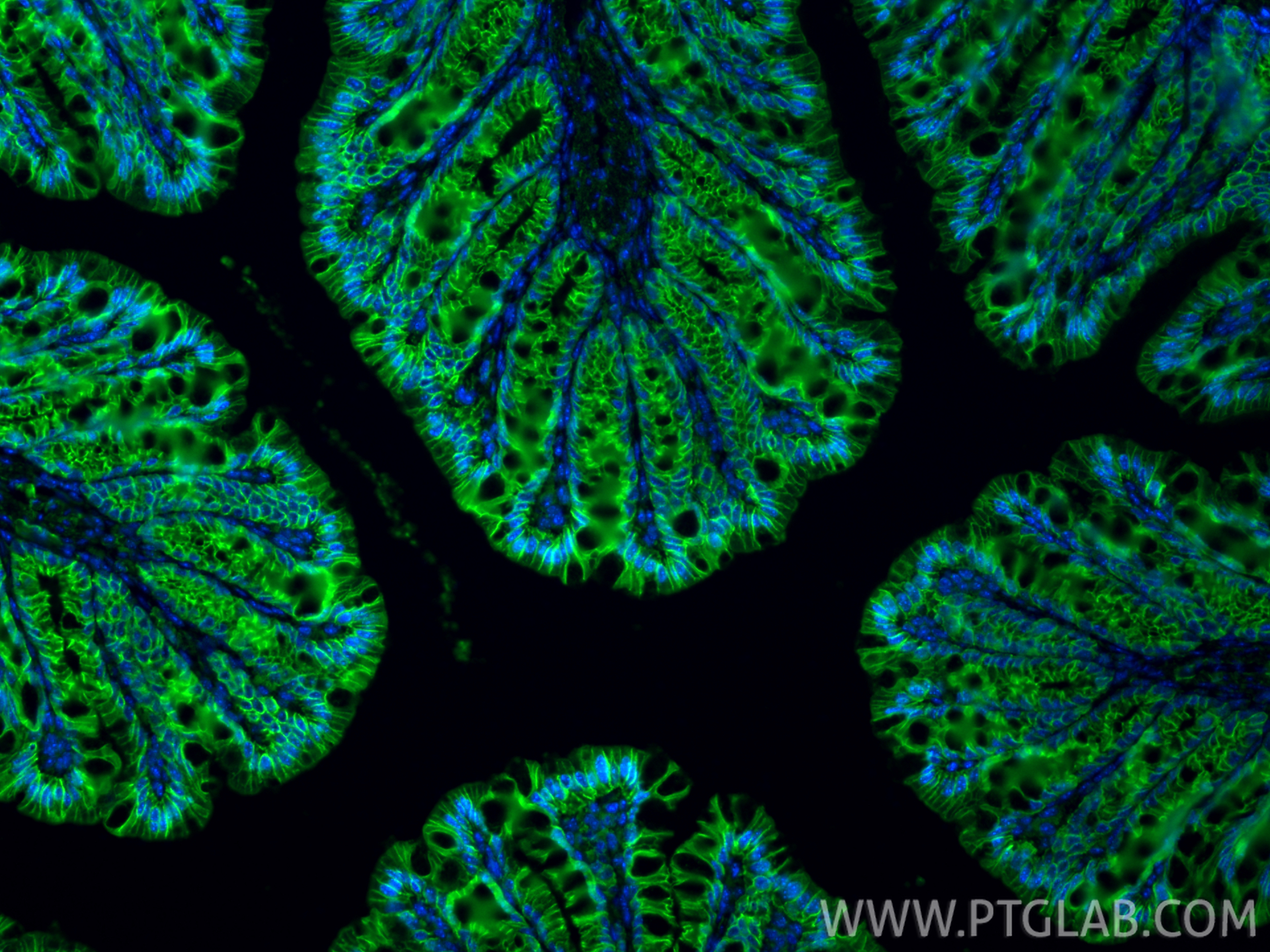 IF Staining of mouse colon using 17565-1-AP