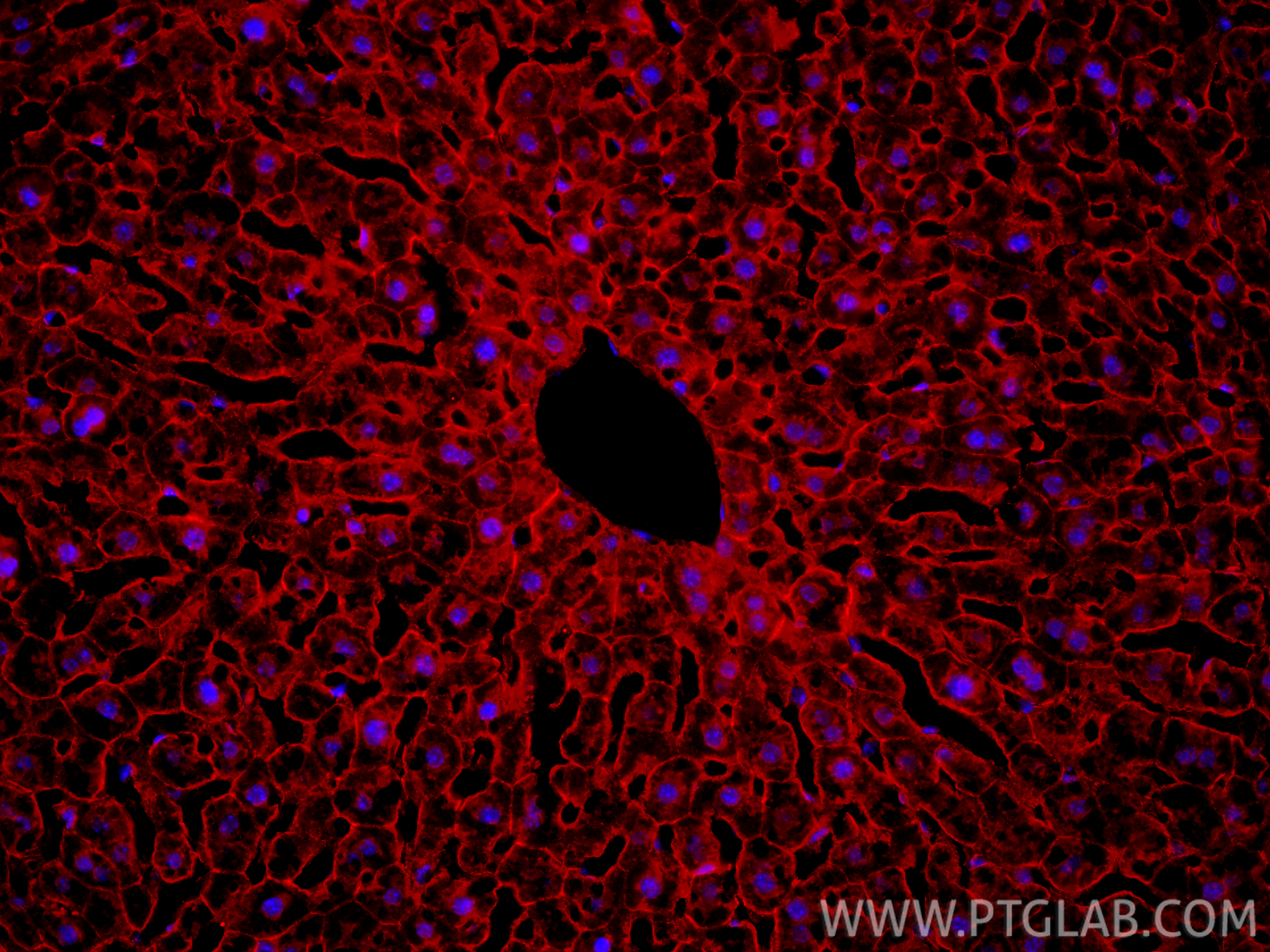 IF Staining of mouse liver using 17565-1-AP IF Staining of mouse liver using 17565-1-AP