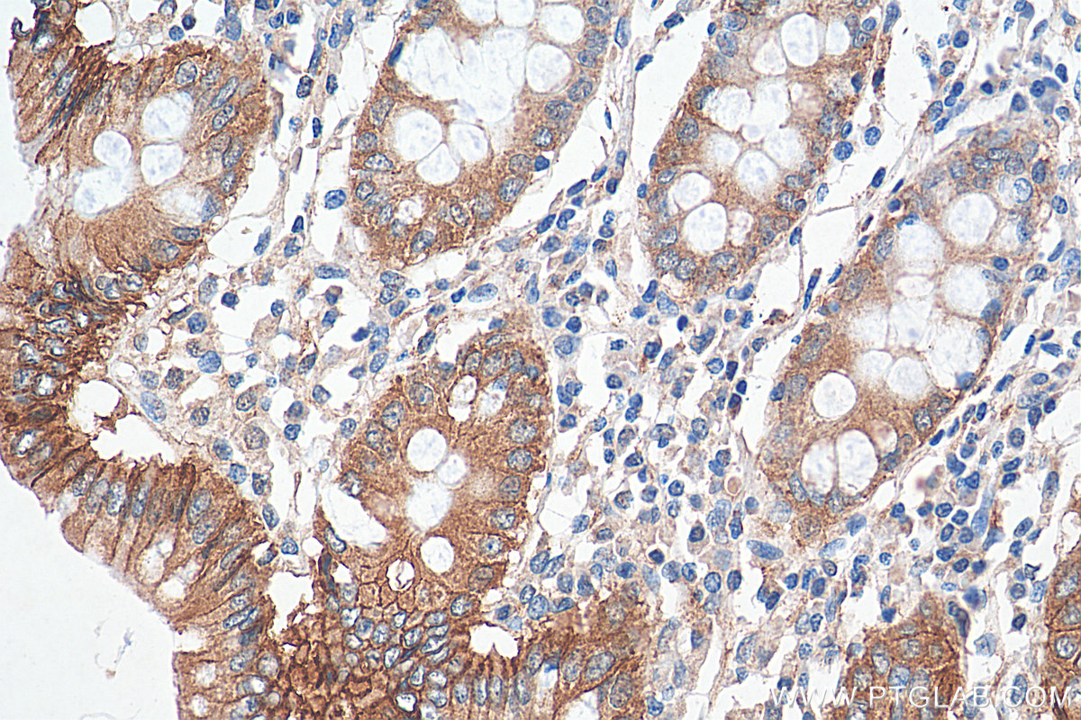 IHC staining of human colon using 17565-1-AP
