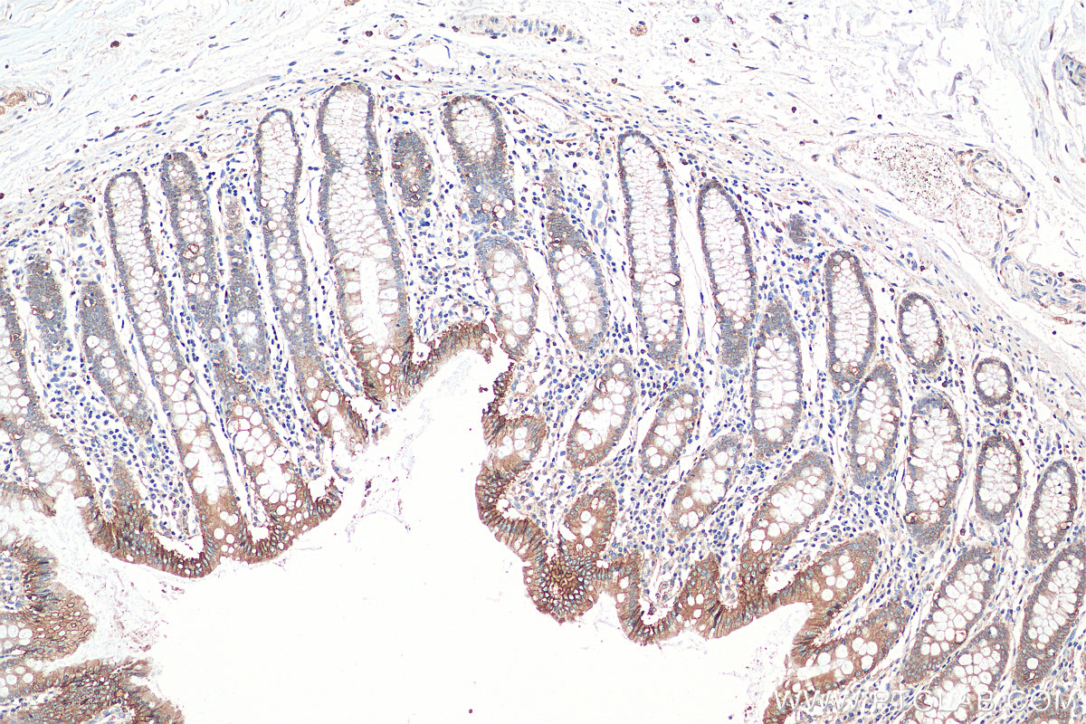 IHC staining of human colon using 17565-1-AP