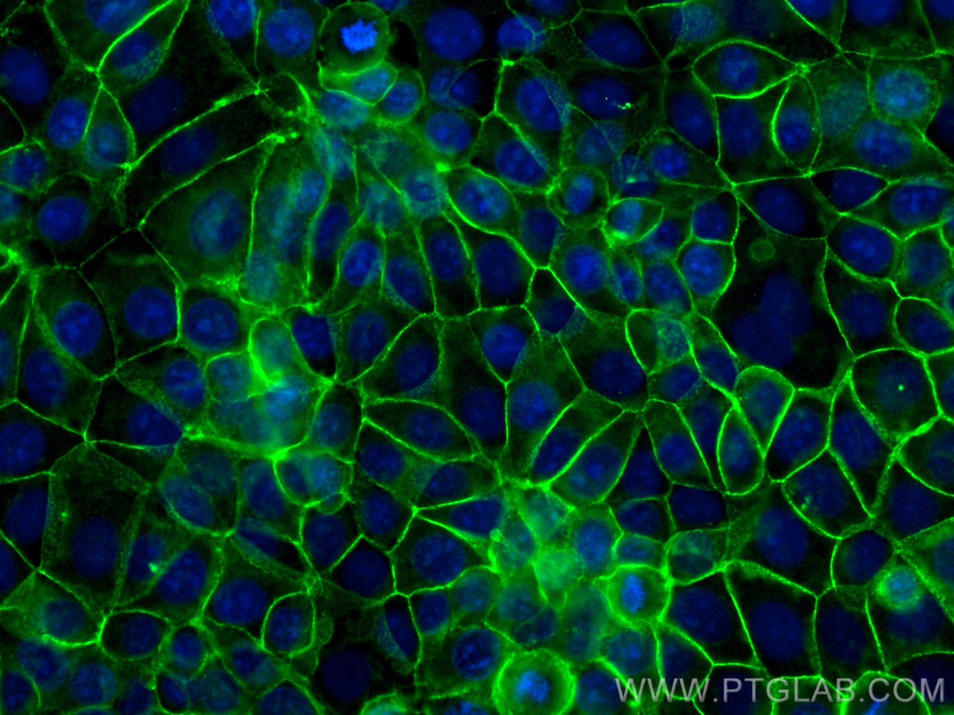 IF Staining of MCF-7 using 51067-2-AP