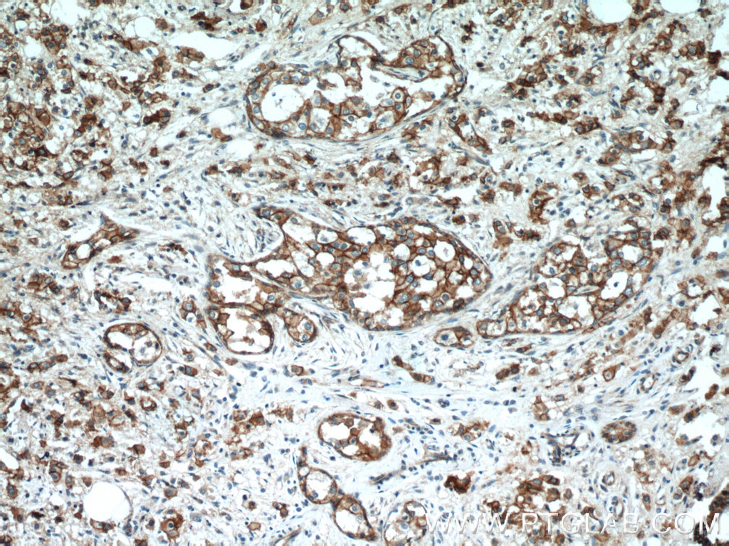 Beta Catenin Polyclonal antibody