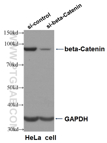 Beta Catenin Polyclonal antibody