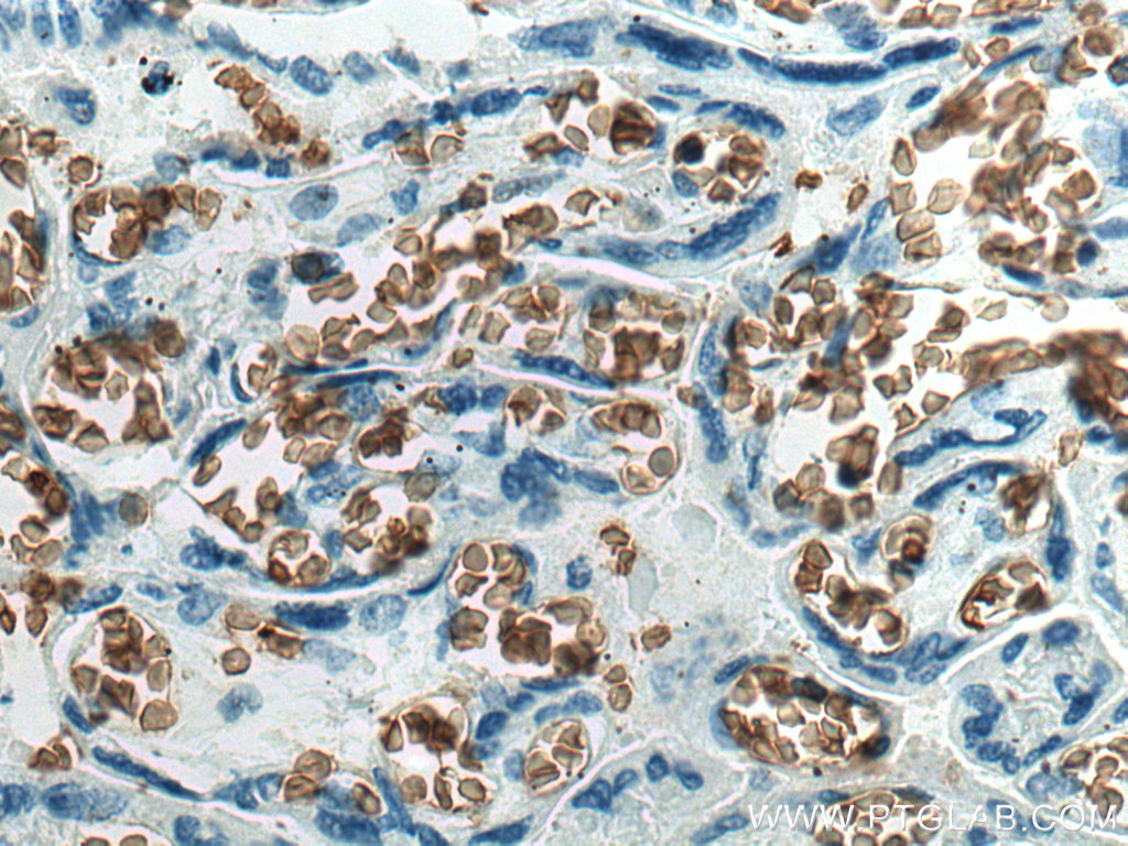 IHC staining of human placenta using 66984-1-Ig