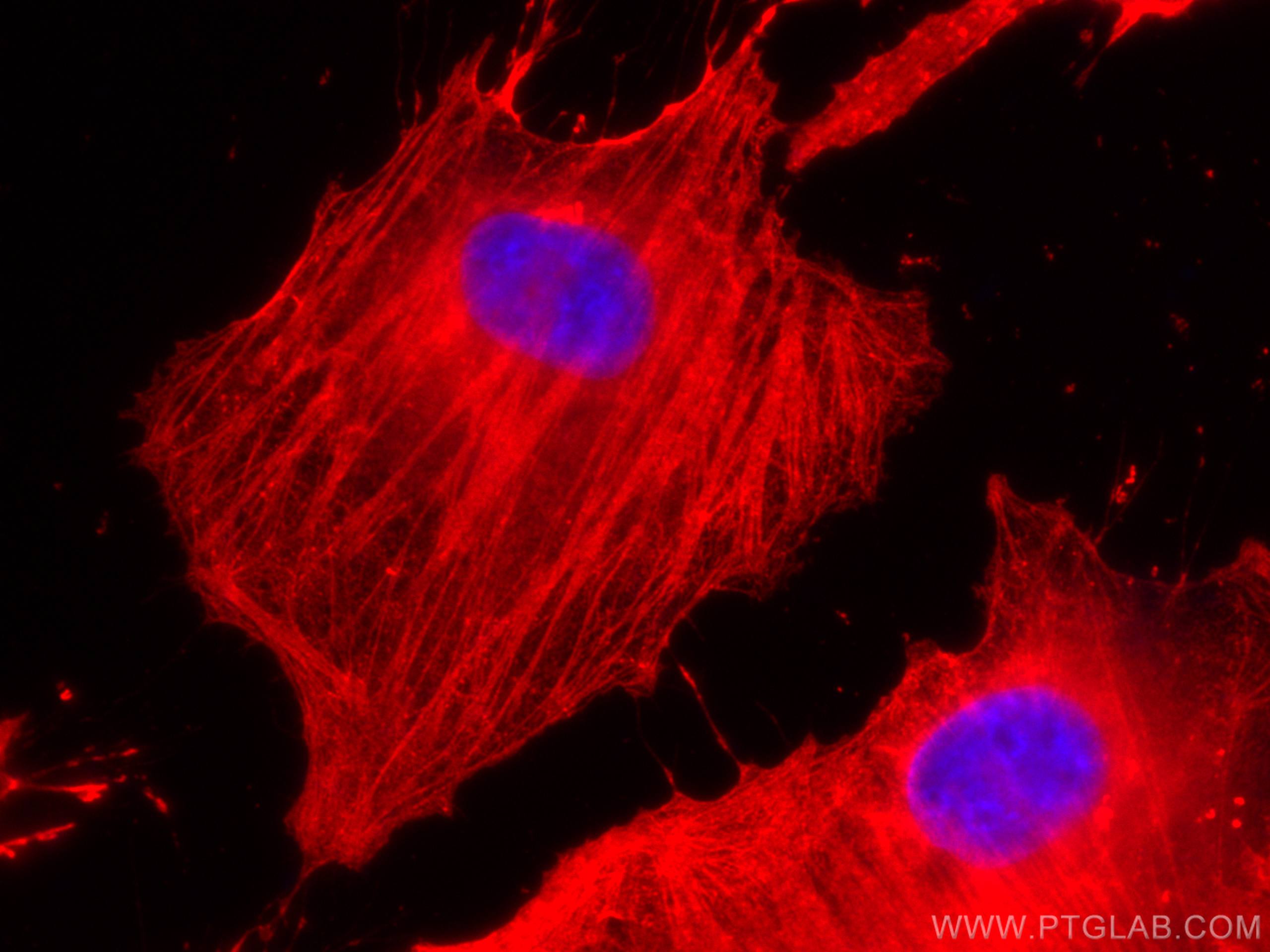 IF Staining of HeLa using CL594-60008