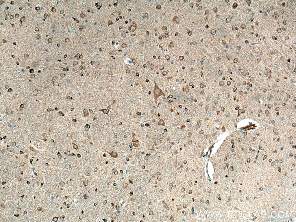 IHC staining of mouse brain using 27320-1-AP