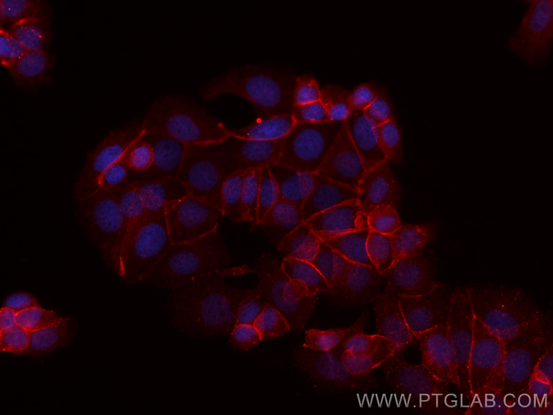 IF Staining of MCF-7 using CL594-66379