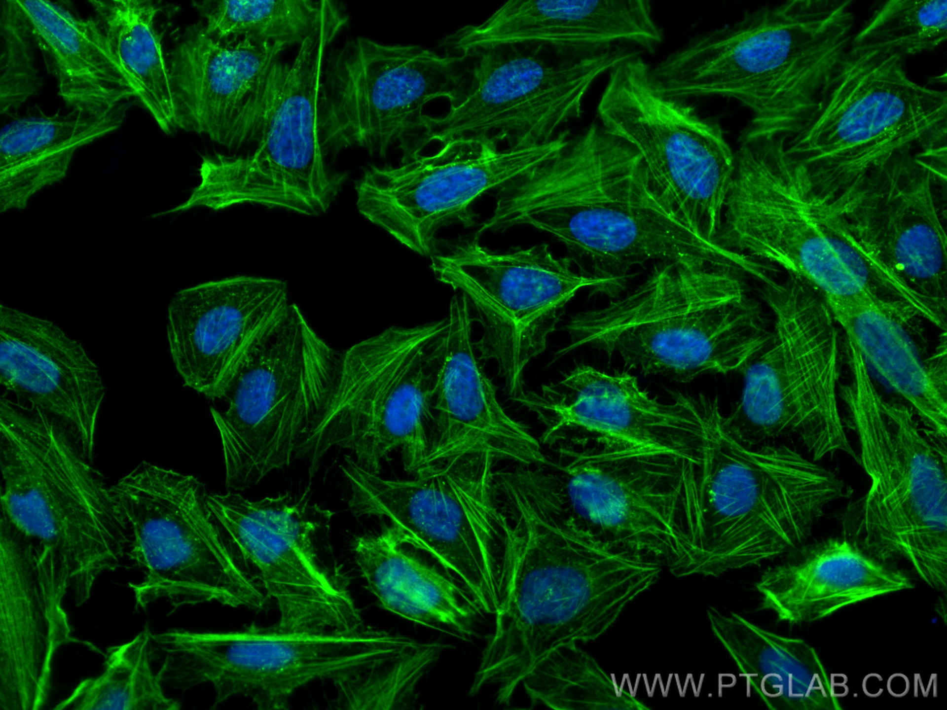 IF Staining of U2OS using 81115-1-RR (same clone as 81115-1-PBS)