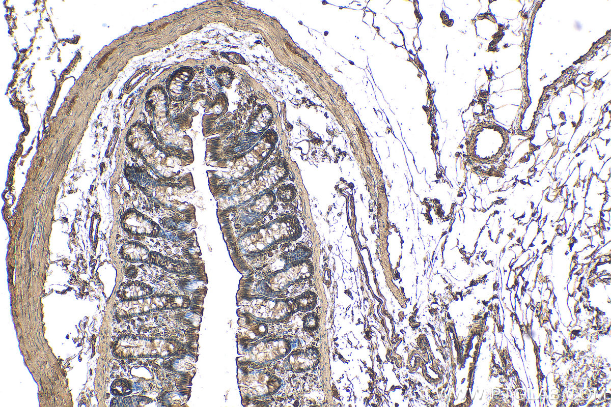 IHC staining of rat colon using 81115-1-RR (same clone as 81115-1-PBS)