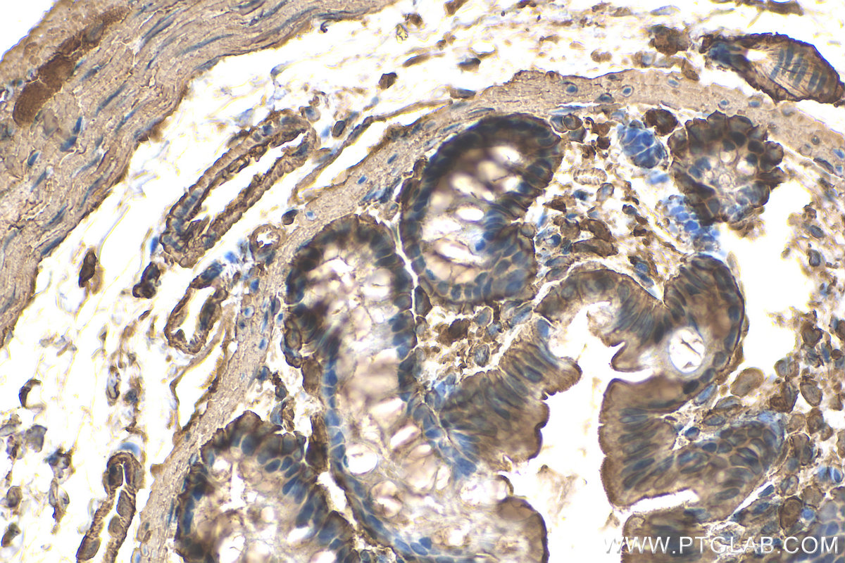 IHC staining of rat colon using 81115-1-RR (same clone as 81115-1-PBS)