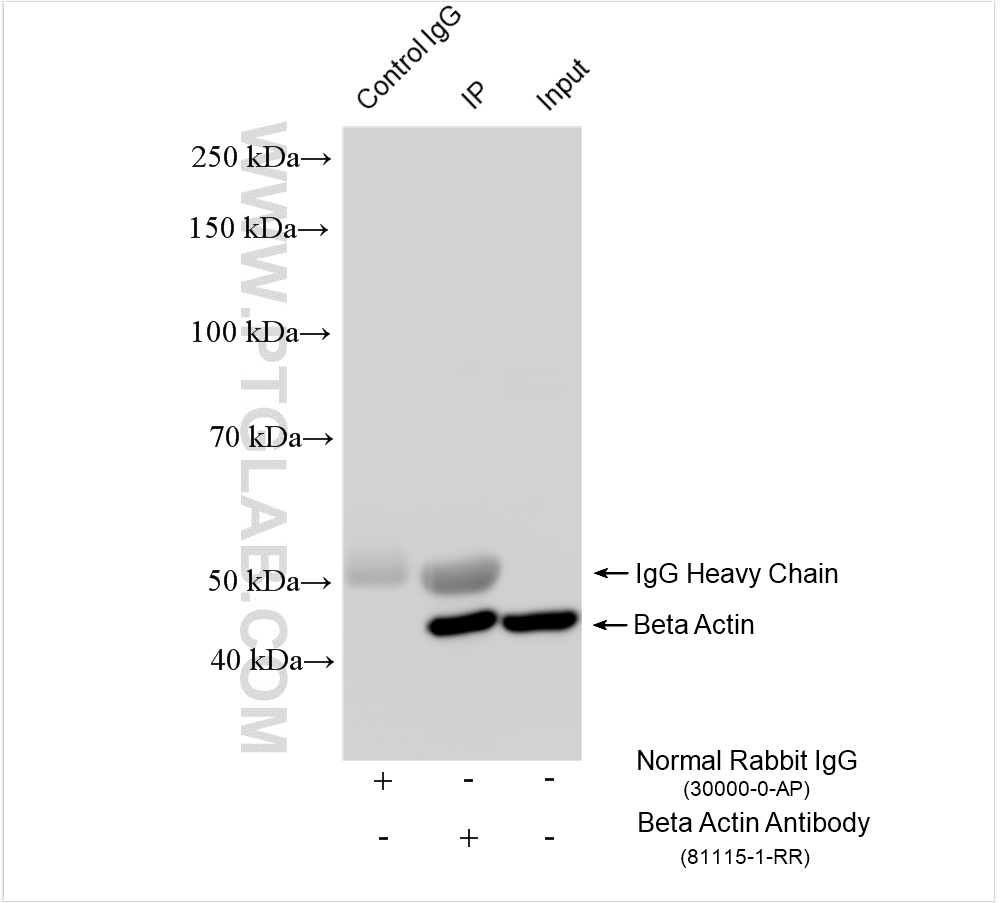 IP experiment of HeLa using 81115-1-RR