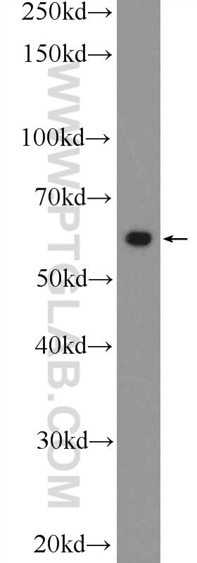 WB analysis of A431 using 25978-1-AP