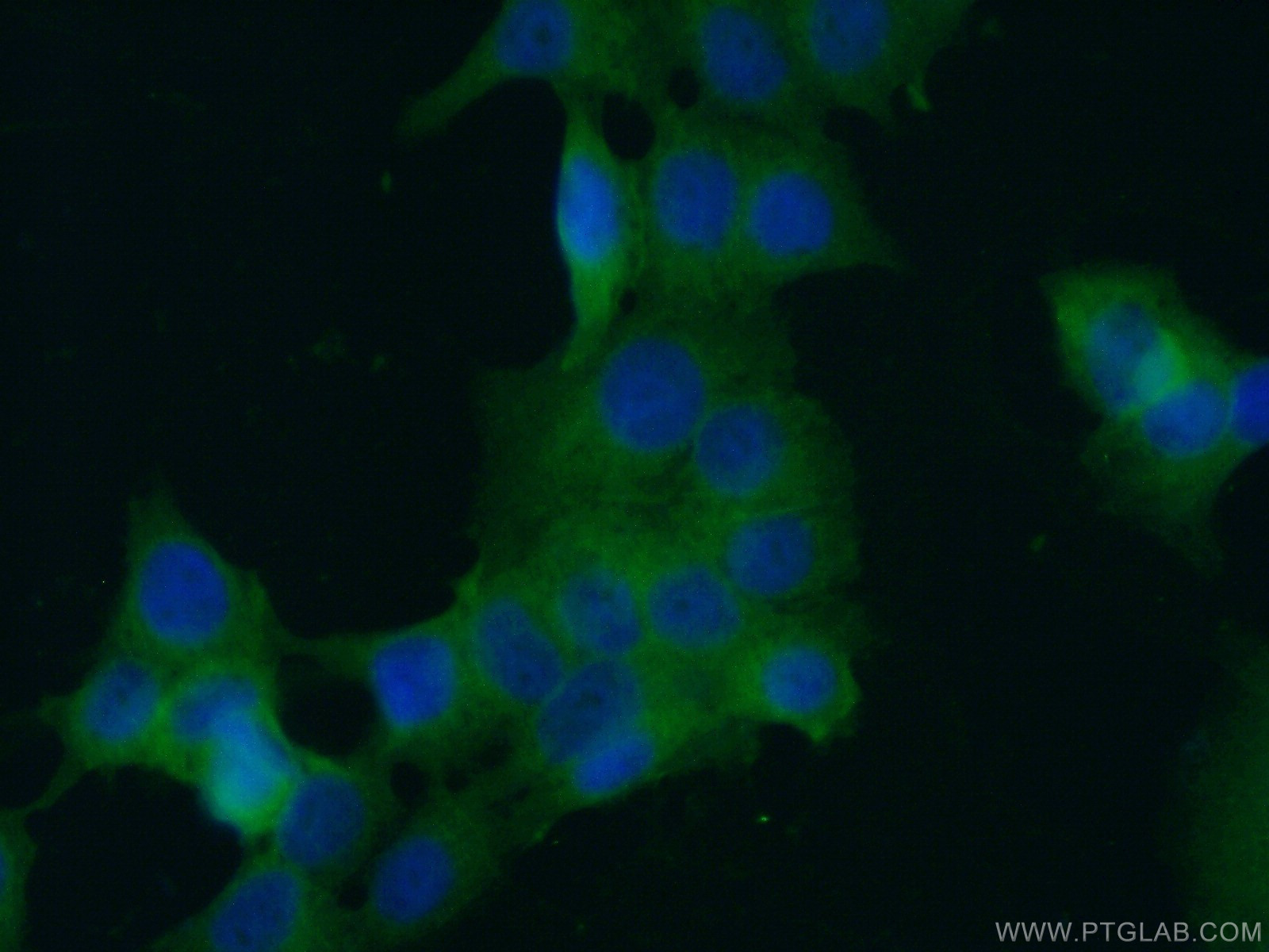 IF Staining of MCF-7 using 60315-1-Ig