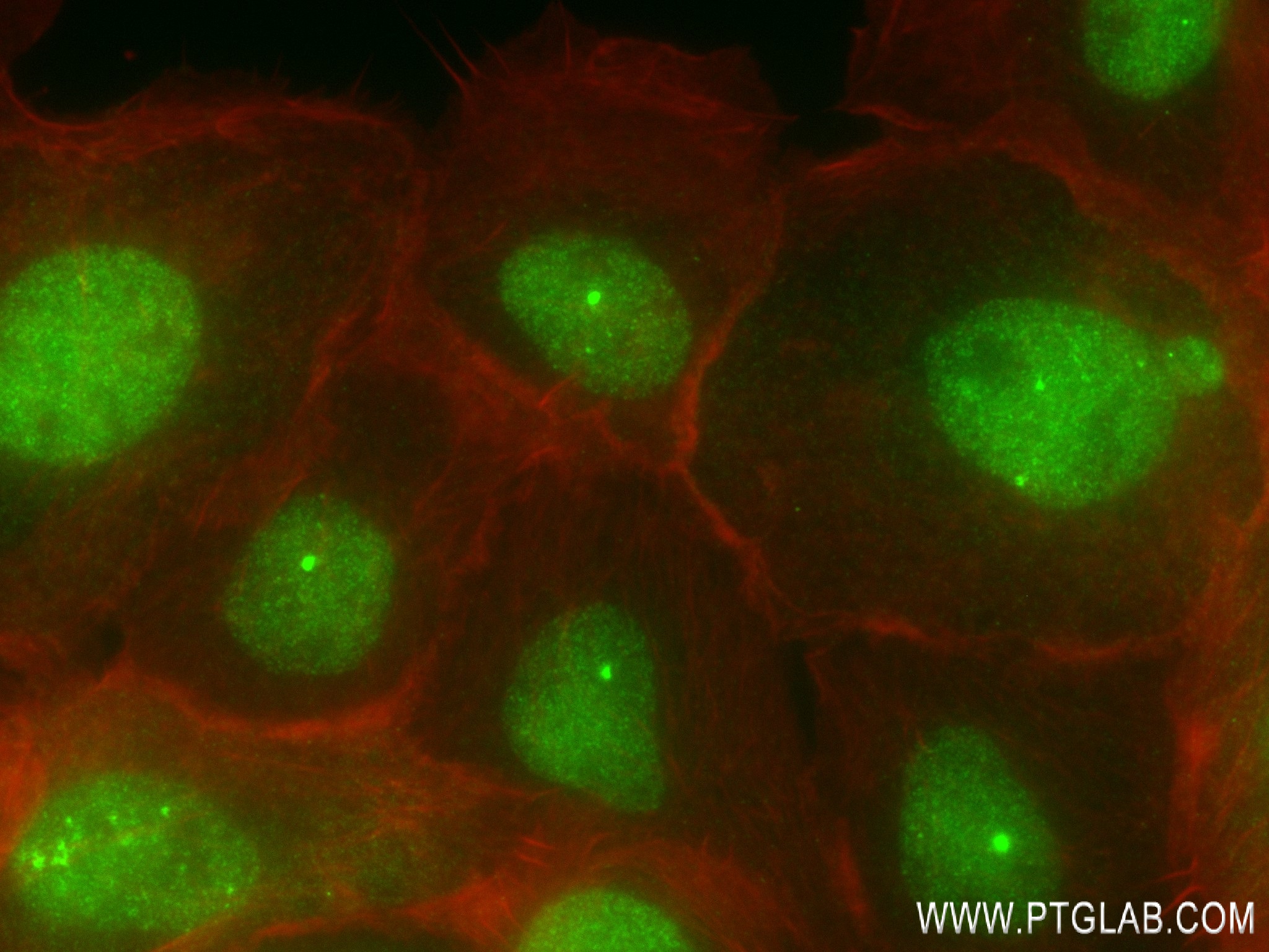 IF Staining of A431 using 82869-1-RR (same clone as 82869-1-PBS)
