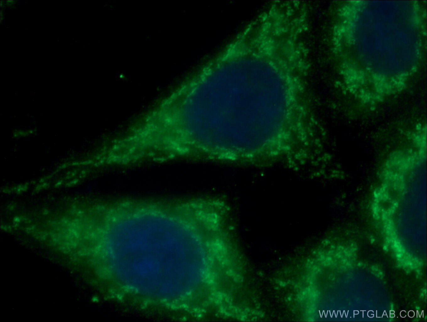 IF Staining of HepG2 using 66626-1-Ig