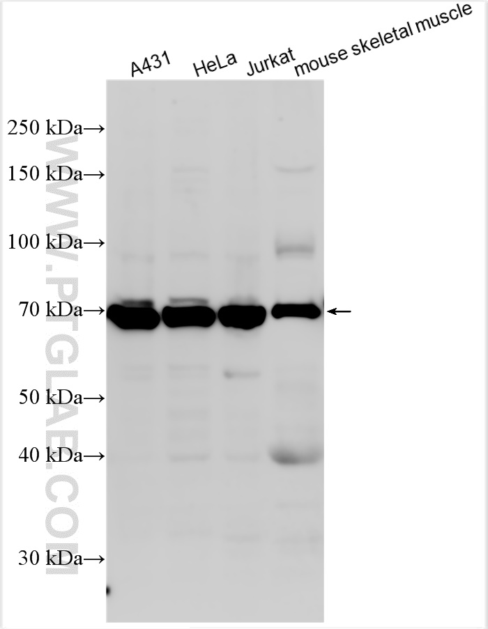 WB analysis using 66626-1-Ig