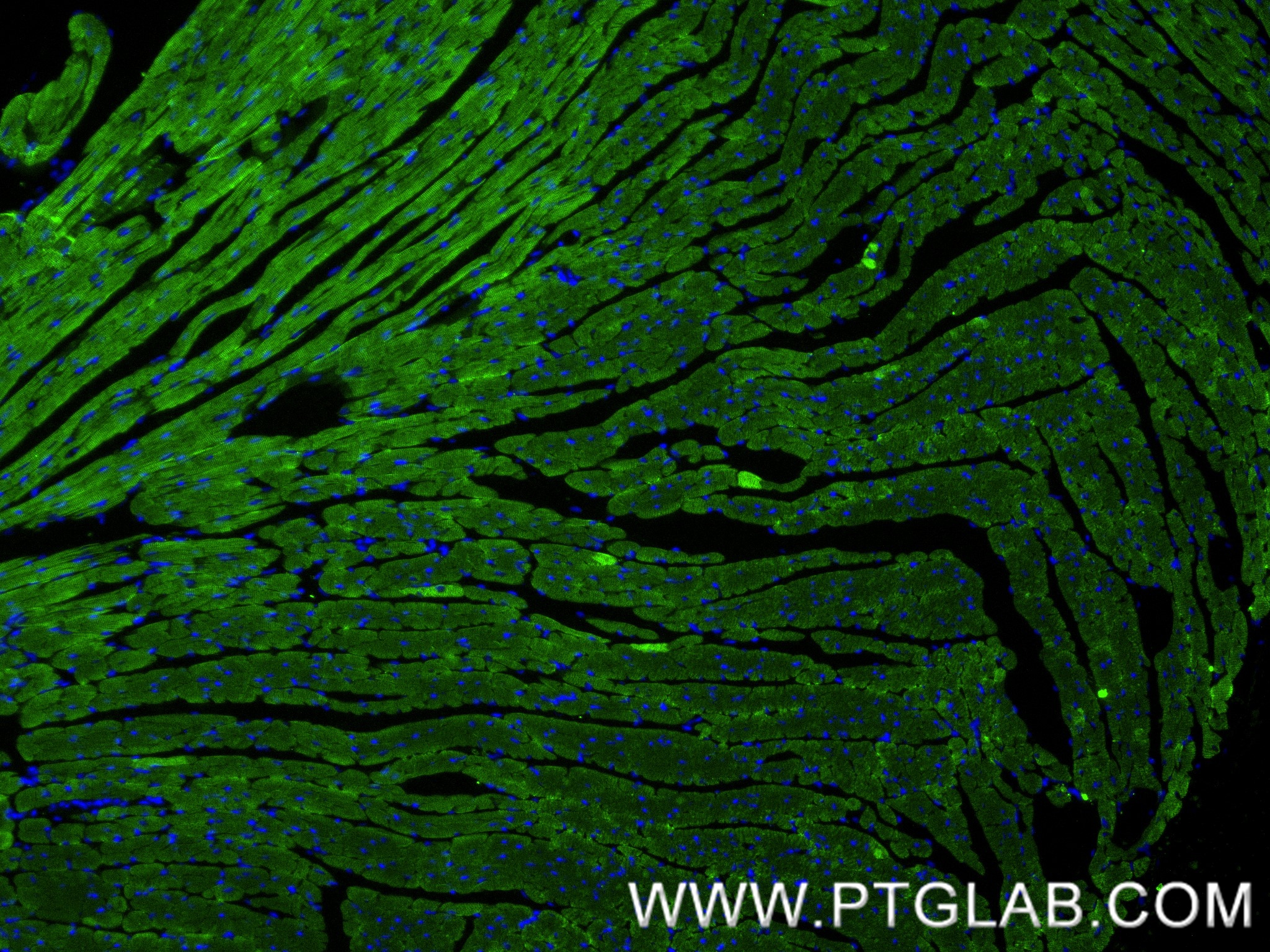 IF Staining of mouse heart using 81638-3-RR