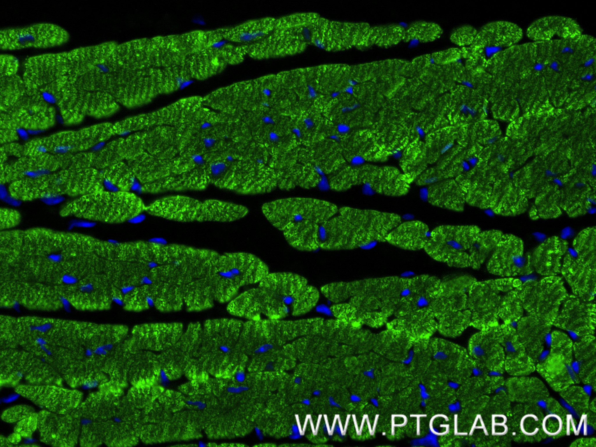 IF Staining of mouse heart using 81638-3-RR