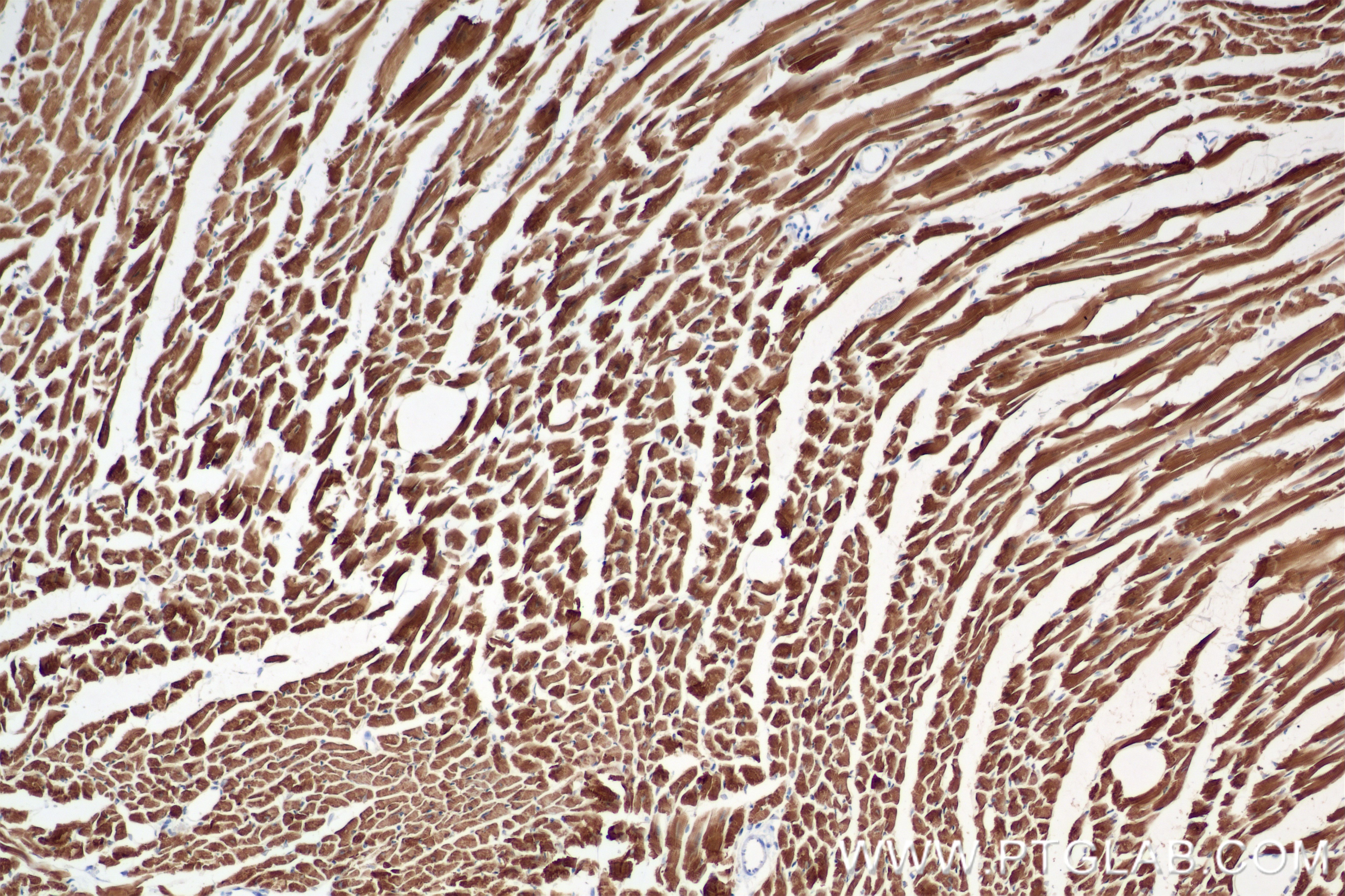 IHC staining of mouse heart using 81638-3-RR