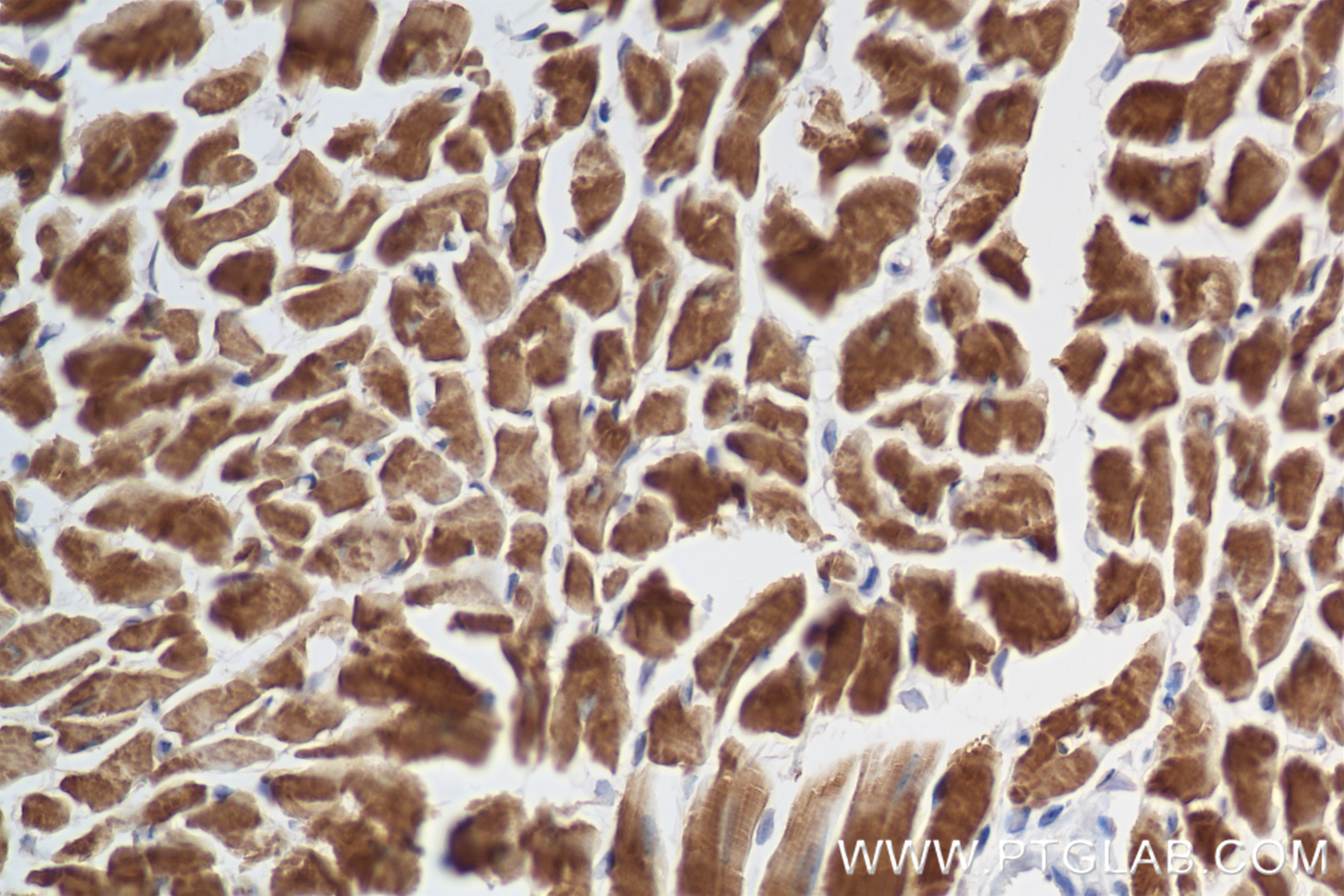 IHC staining of mouse heart using 81638-3-RR