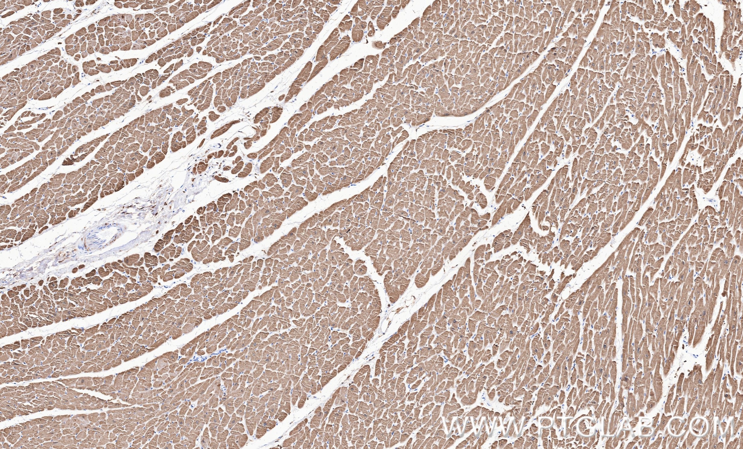 IHC staining of human heart using 81638-3-RR