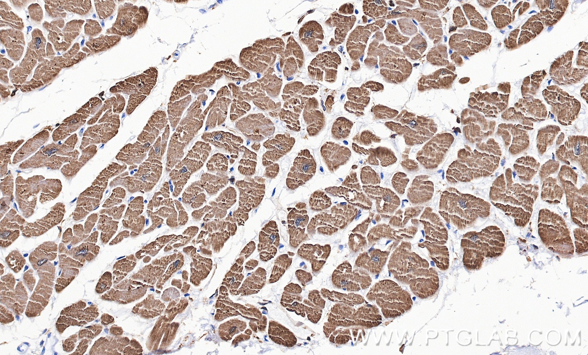IHC staining of human heart using 81638-3-RR