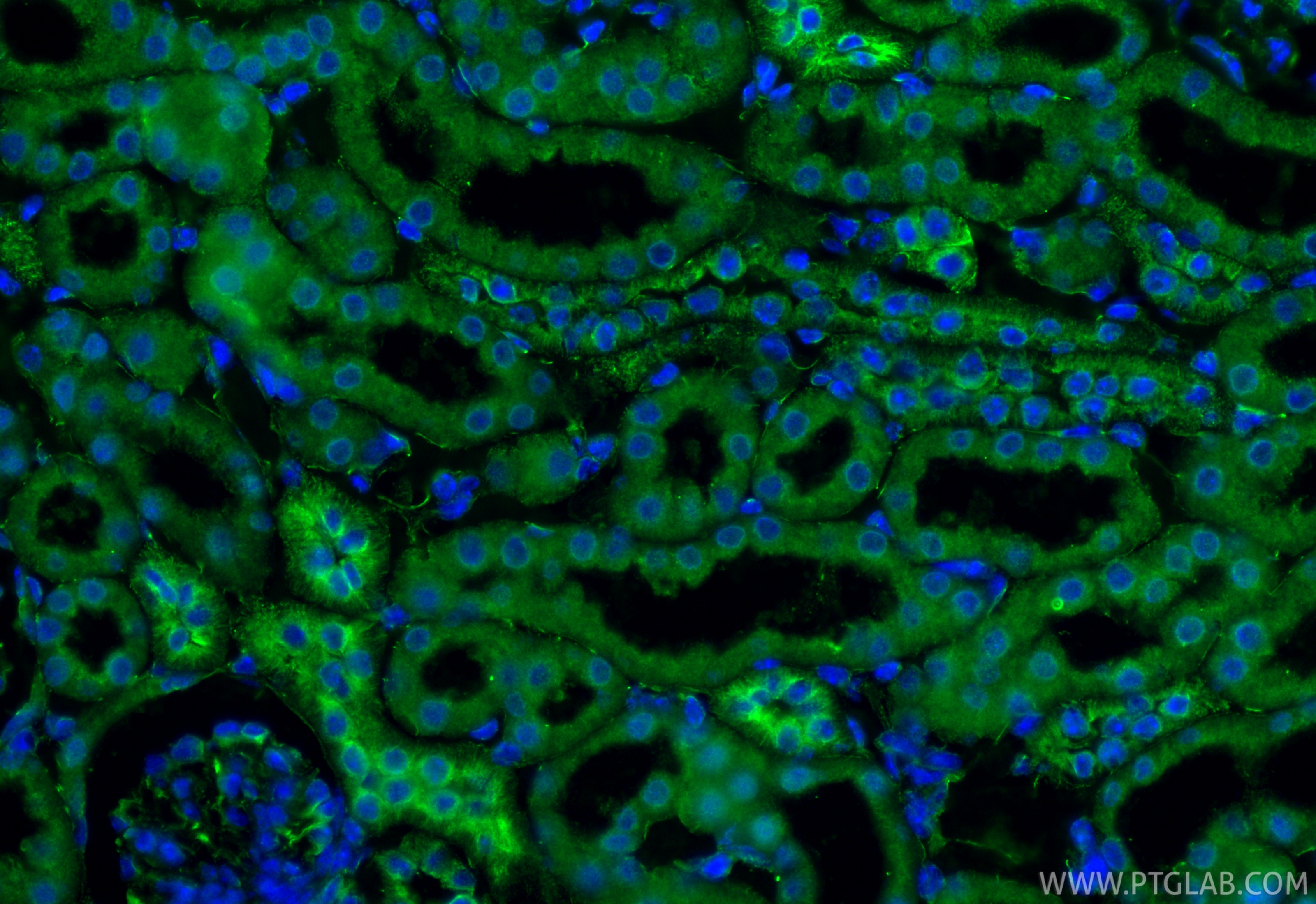 IF Staining of mouse kidney using 80017-1-RR (same clone as 80017-1-PBS)